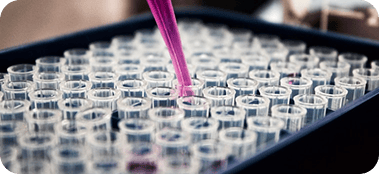 Bandeja de tubos de ensayo con pipeta dispensando líquido púrpura.