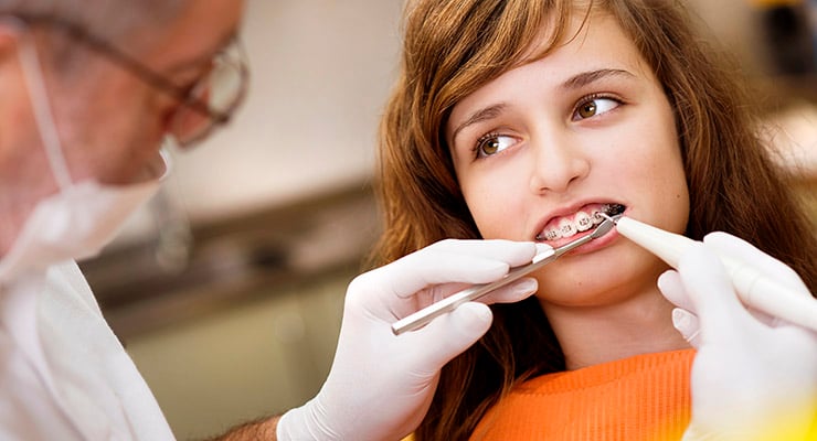 Profesional dental ajustando frenillos en los dientes de una adolescente