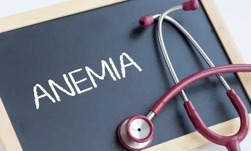 Pizarra con la palabra anemia y estetoscopio médico sobre la mesa