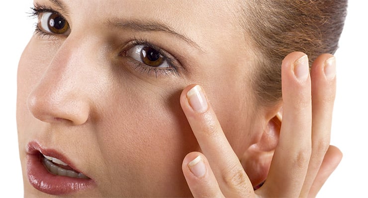 Primer plano del rostro de una mujer señalando arrugas finas en el contorno de los ojos.