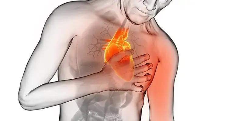 Ilustración de un hombre sujetando el pecho con el corazón resaltado en color naranja