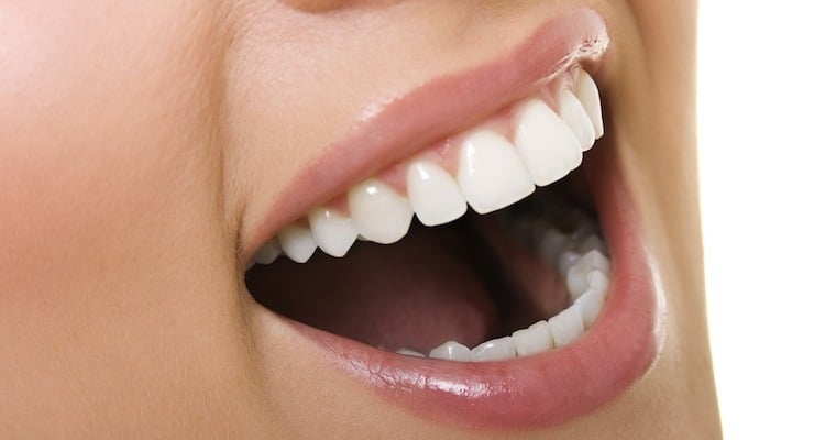 Primer plano de una boca abierta mostrando dientes blancos y encías