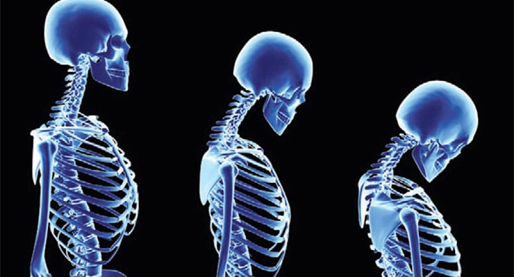 Ilustración de esqueletos mostrando cambios progresivos en la postura de la columna vertebral.
