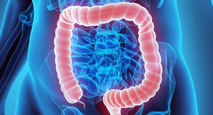 Ilustración médica del colon y el intestino grueso resaltado en el abdomen