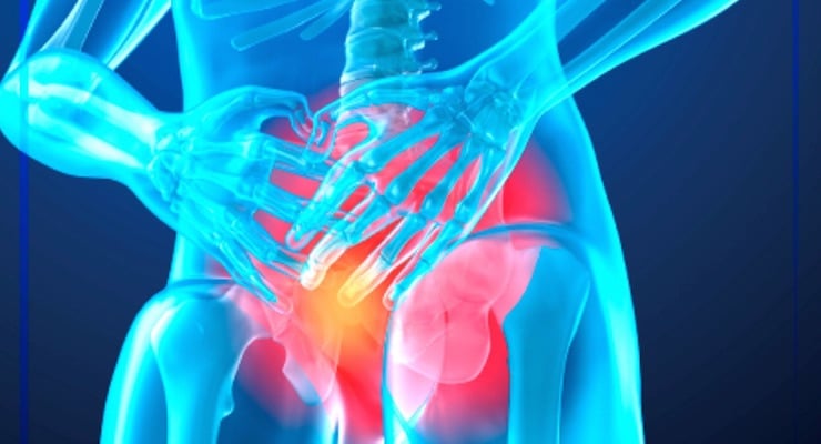Ilustración médica de pelvis masculina con próstata resaltada en rojo