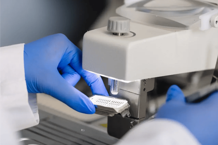 Primer plano de las manos de un especialista con guantes azules manipulando un casete de tejido histológico en un micrótomo del Laboratorio de Patología del Hospital Clínica Bíblica.