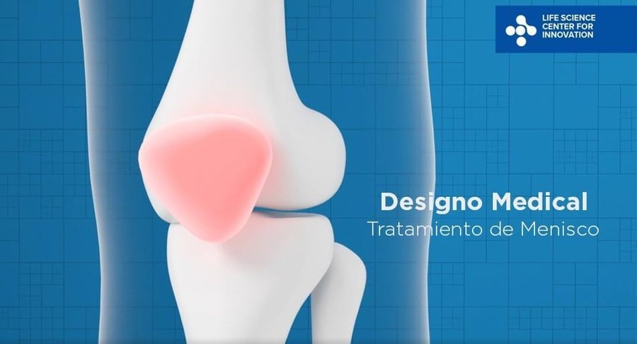 Ilustración médica de la articulación de la rodilla que representa el tratamiento de menisco desarrollado por Designo Medical.
