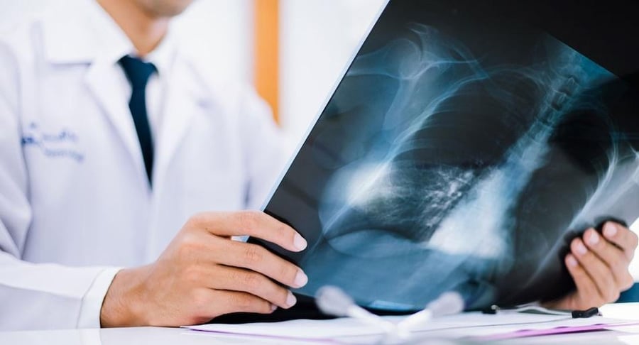 Un médico con bata blanca sostiene y analiza una radiografía de tórax, representando la importancia de los chequeos preventivos y la detección precoz.