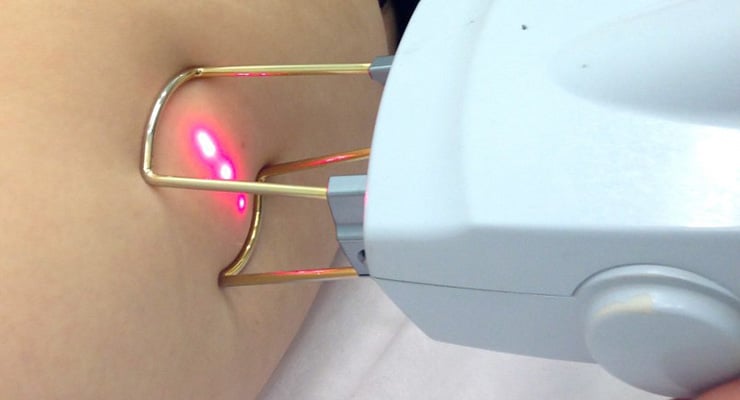 Dispositivo médico aplicando tratamiento con luz sobre la piel