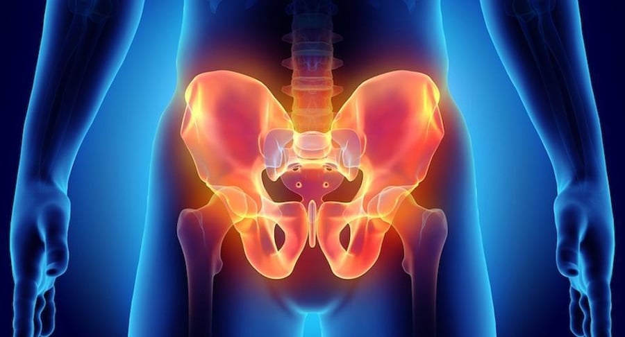 Ilustración médica en 3D de la región pélvica femenina resaltada en color naranja brillante sobre la silueta de un cuerpo humano, indicando la zona de dolor.
