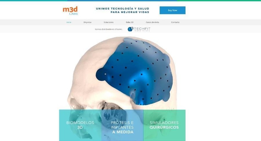 Modelo anatómico de cráneo con implante personalizado desarrollado mediante impresión 3D por m3d LABS.