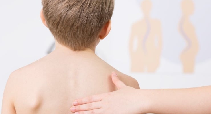 Espalda de un niño mientras un adulto evalúa la postura de la columna