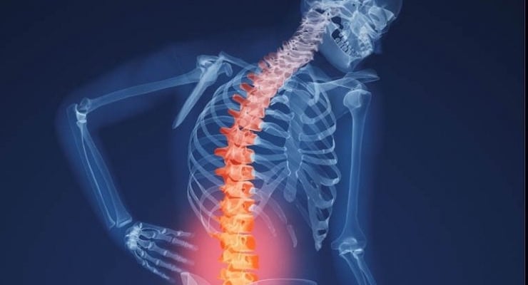 Ilustración de columna vertebral con zona lumbar resaltada en rojo por dolor o fractura