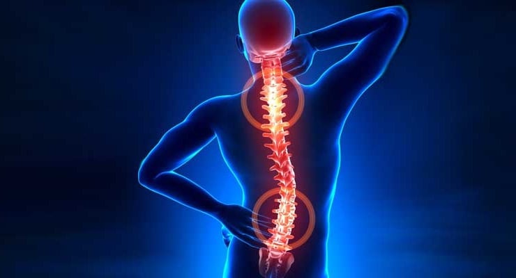 Ilustración médica en 3D de la columna vertebral de un hombre resaltada en rojo brillante, mostrando puntos de dolor en las zonas cervical y lumbar.
