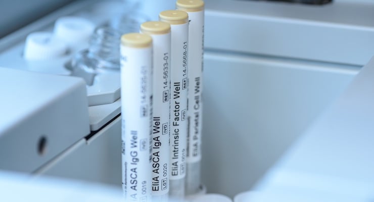 Tubos de ensayo en el laboratorio clínico del Hospital Clínica Bíblica para pruebas de diagnóstico gastrointestinal como enfermedad de Crohn y celíaca.