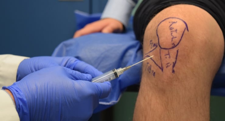 Especialista médico realizando una infiltración de Terapia VIURE en la rodilla de un paciente para la recuperación de tejidos.