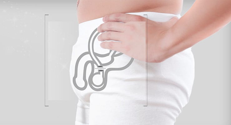 Ilustración del área abdominal masculina con representación del sistema reproductor