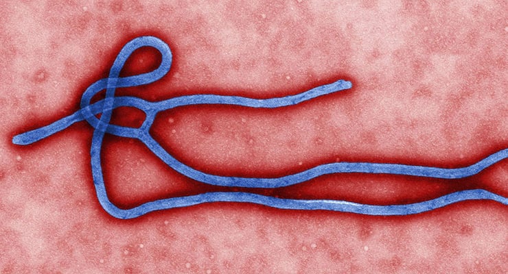 Ilustración microscópica de un virus con forma filamentosa sobre un fondo rosado