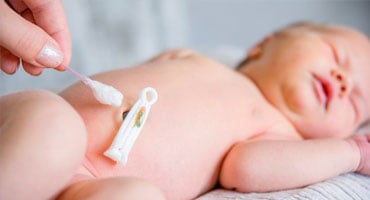 Curación del ombligo de un recién nacido con aplicador de algodón y pinza umbilical