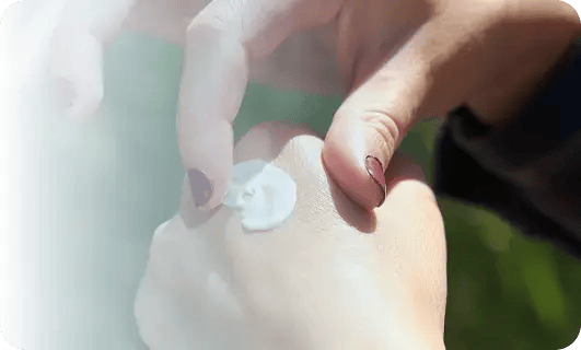 Primer plano de mano aplicando crema dermatológica sobre la piel