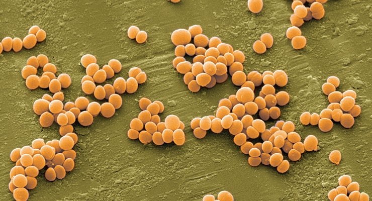 Microorganismos esféricos de color naranja agrupados sobre una superficie verde vistos al microscopio