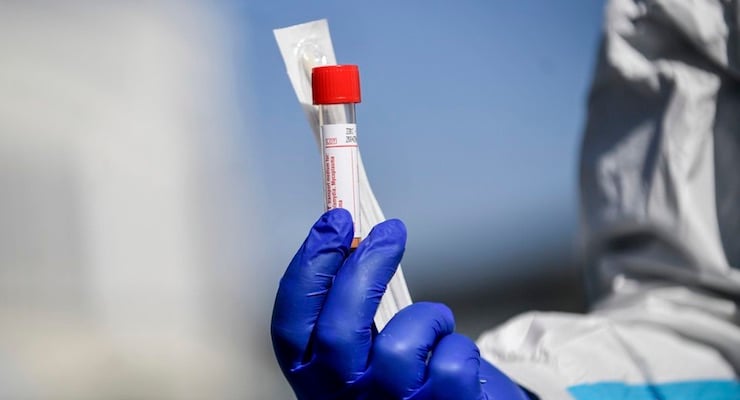 Profesional de salud con guante sosteniendo tubo de muestra para prueba de COVID-19