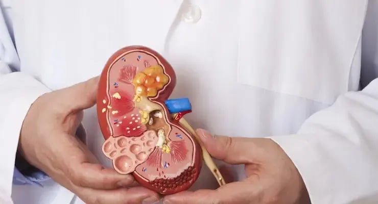 Modelo anatómico de un riñón sostenido por un profesional de la salud.