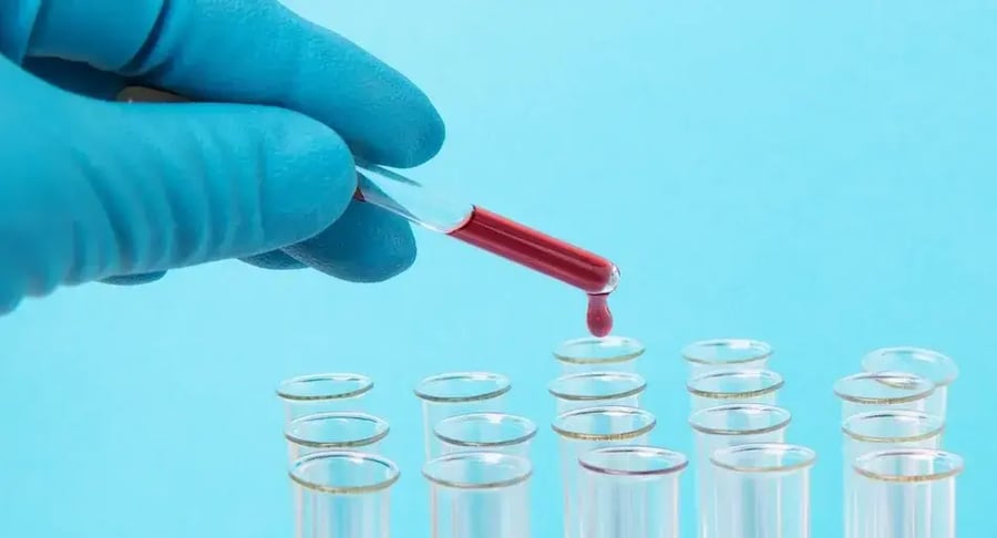 Muestra de sangre en pipeta de laboratorio lista para análisis clínico