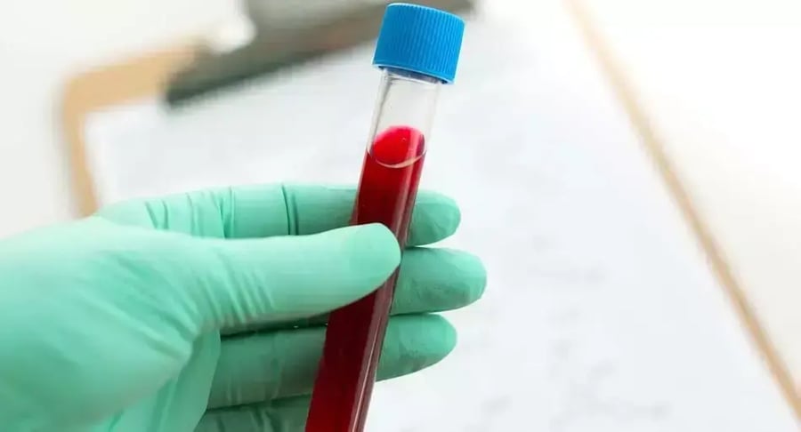 Muestra de sangre en pipeta de laboratorio lista para análisis clínico