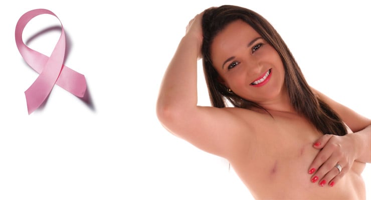 Mujer sonriente mostrando la axila con cicatriz quirúrgica y lazo rosa de concientización