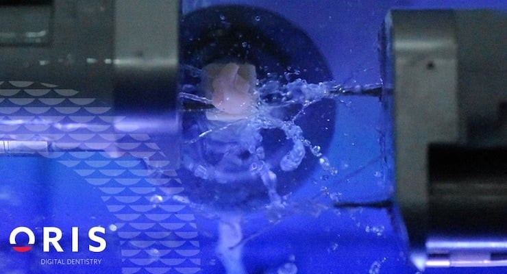 Equipo de odontología digital realiza proceso de fabricación asistida por computadora para restauraciones dentales