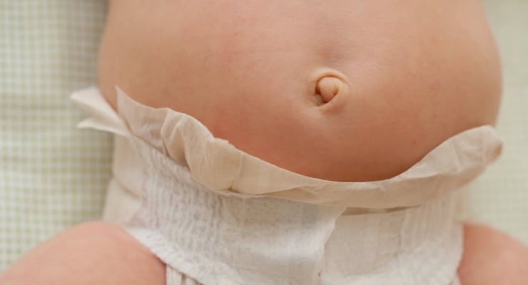 Ombligo de un recién nacido con pañal colocado por debajo de la zona umbilical