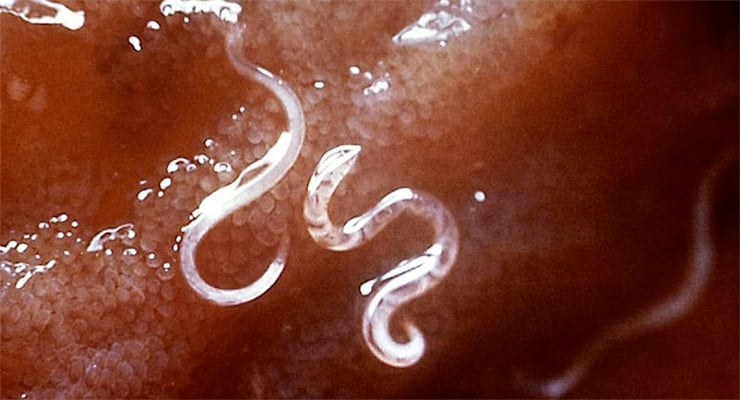 Parásitos intestinales observados en una muestra biológica, con formas alargadas y translúcidas.