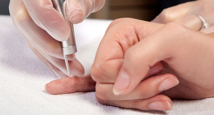 Profesional de la salud realizando un procedimiento con instrumento médico en el dedo de una persona