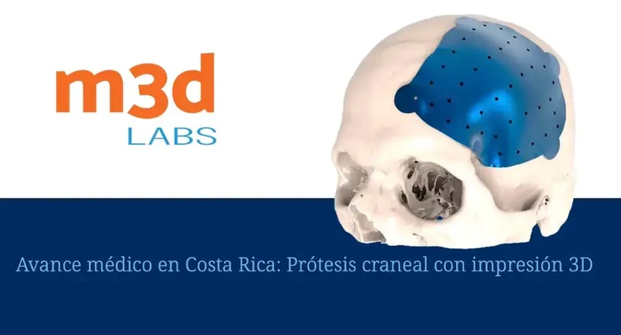 Prótesis craneal con impresión 3D desarrollada por m3d Labs en Costa Rica como avance médico