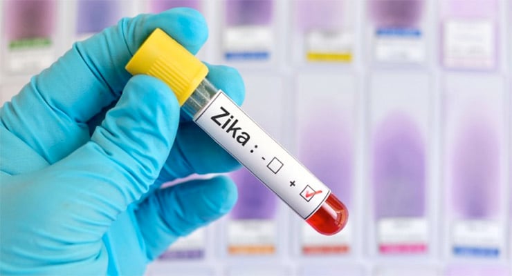 Tubo de ensayo con muestra de sangre rotulada como prueba positiva de zika sostenida por mano con guante médico.