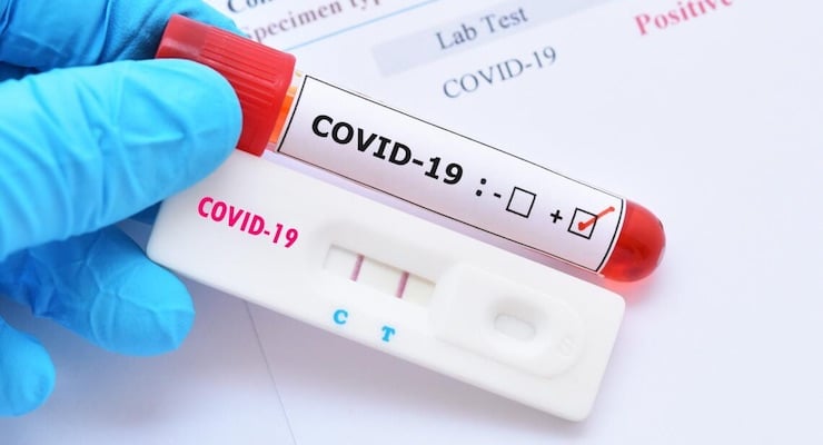 Mano con guante azul sosteniendo un tubo de ensayo con sangre y una prueba rápida de antígenos con resultado positivo para COVID-19.