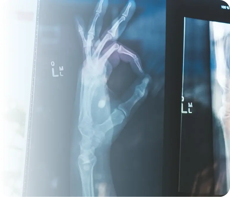 Hand x-ray showing ok sign on medical screen
