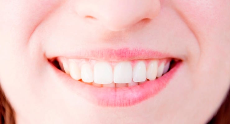 Primer plano de una sonrisa saludable con dientes blancos y alineados que muestra los resultados de un tratamiento de rejuvenecimiento dental.