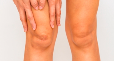 Persona colocando la mano sobre la rodilla mostrando posible molestia