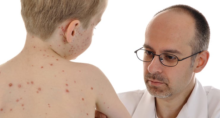 Médico observando la espalda de un niño con múltiples erupciones cutáneas visibles.