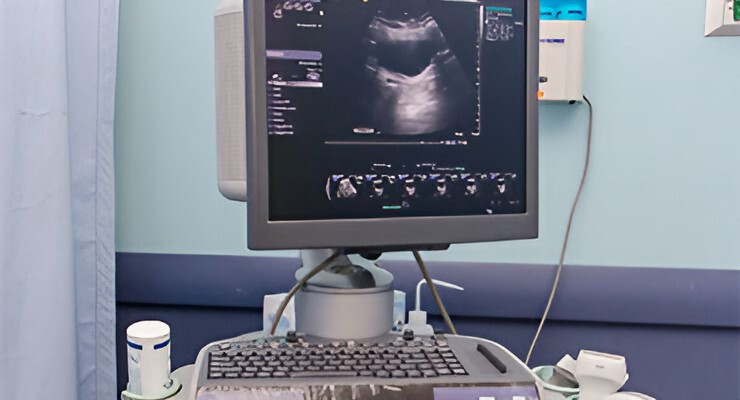 Equipo de ultrasonido endobronquial con monitor y consola médica