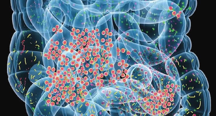 Ilustración médica del intestino con representación de virus y bacterias en su interior