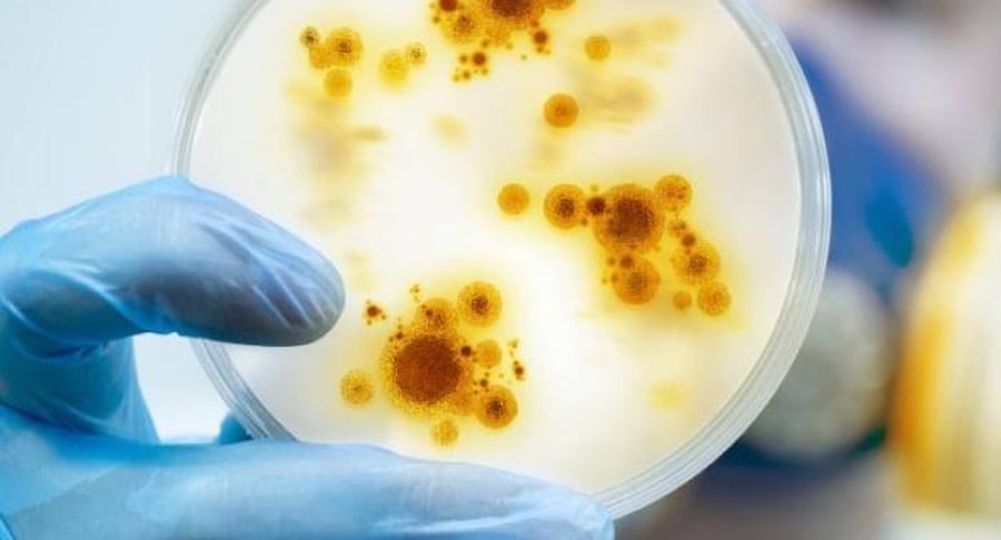 Muestra de laboratorio en placa de Petri con cultivos bacterianos o virales analizados por un especialista con guantes quirúrgicos.