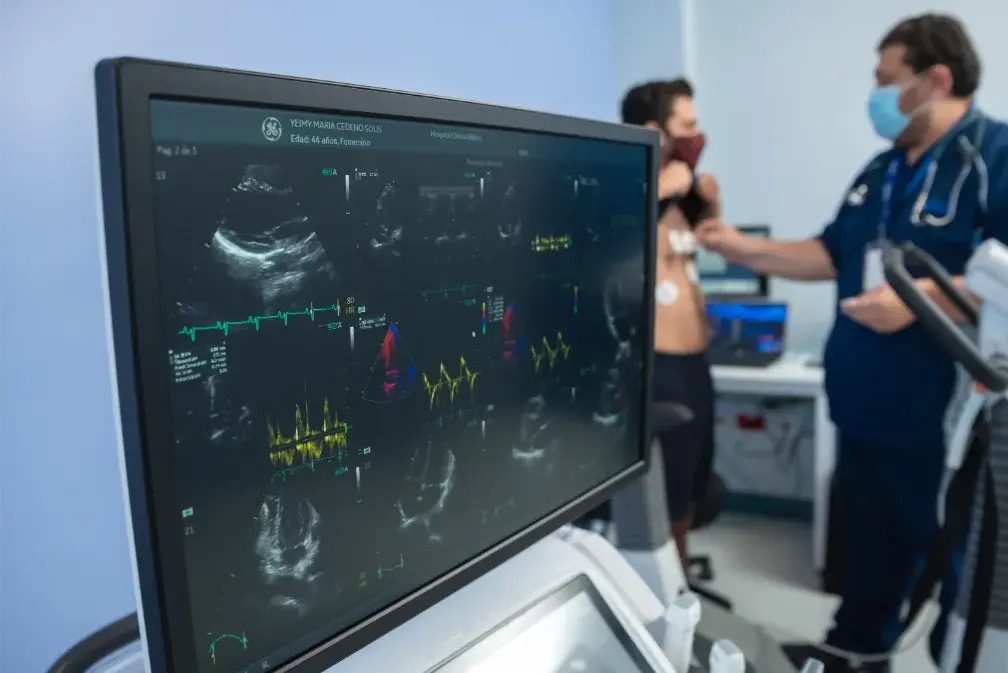 Pantalla mostrando gráficos de ecocardiograma durante examen médico Pantalla mostrando gráficos de ecocardiograma durante examen médico