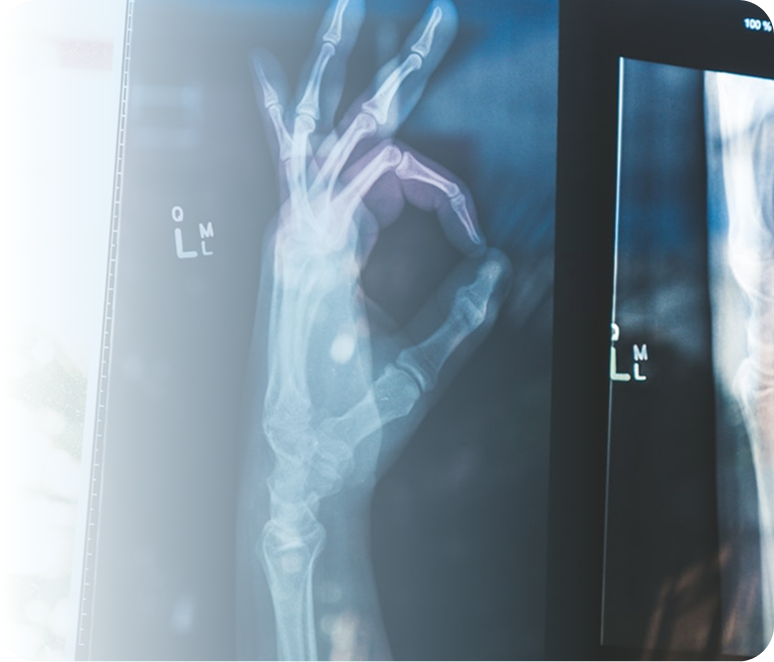 Hand x-ray showing ok sign on medical screen