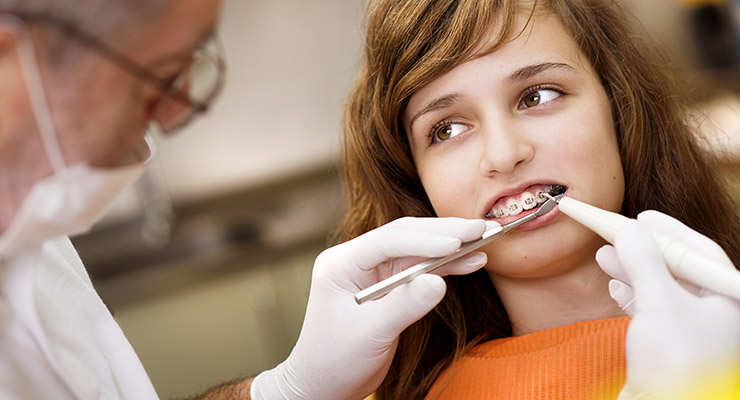 Los frenillos no son una moda