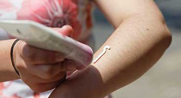 En esta época, cuide su piel de los rayos ultravioletas