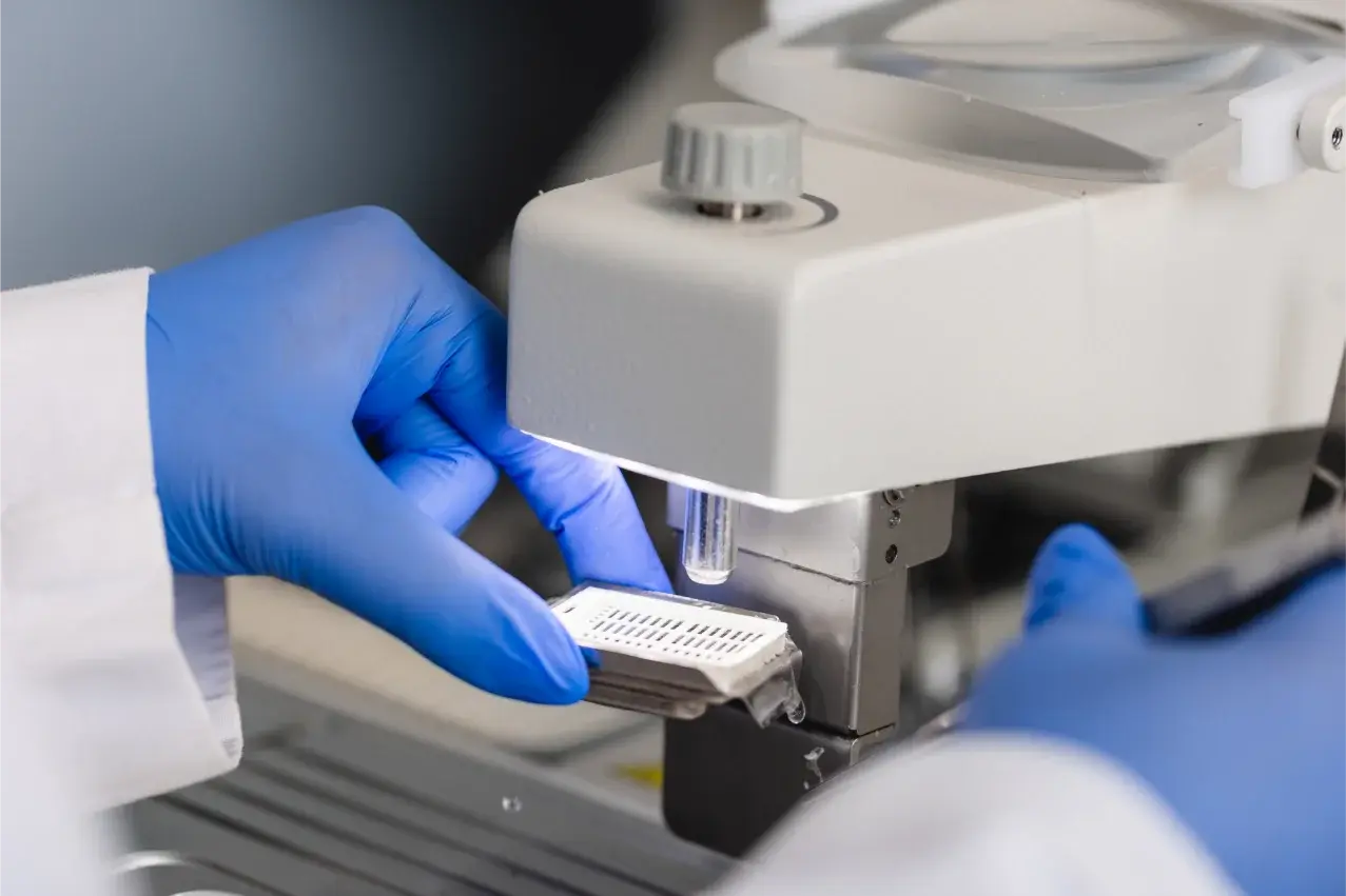 Primer plano de las manos de un especialista con guantes azules manipulando un casete de tejido histológico en un micrótomo del Laboratorio de Patología del Hospital Clínica Bíblica.