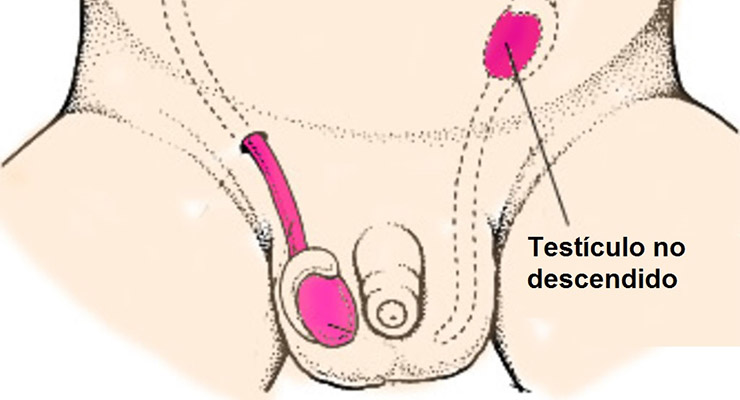 Desarrollo del testículo desde el recién nacido hasta la pubertad